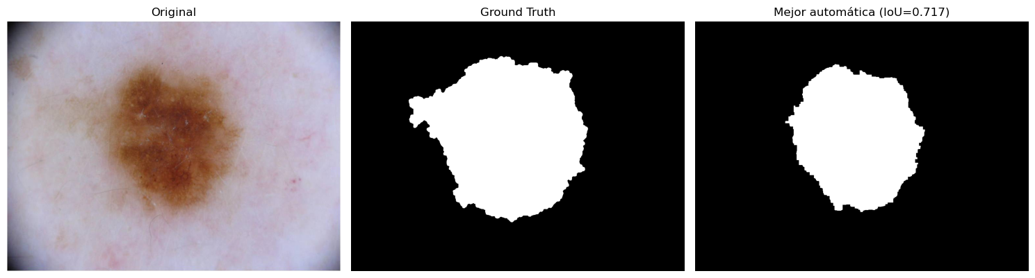 Segmentation example: original lesion, ground truth mask and automatic segmentation